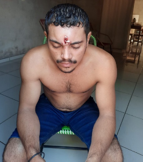 Homem é baleado com tiro na testa, perde massa encefálica e vai para casa dormir