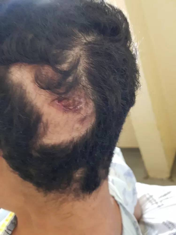 Homem é agredido com pedra em Sete Lagoas; autor foi preso em flagrante